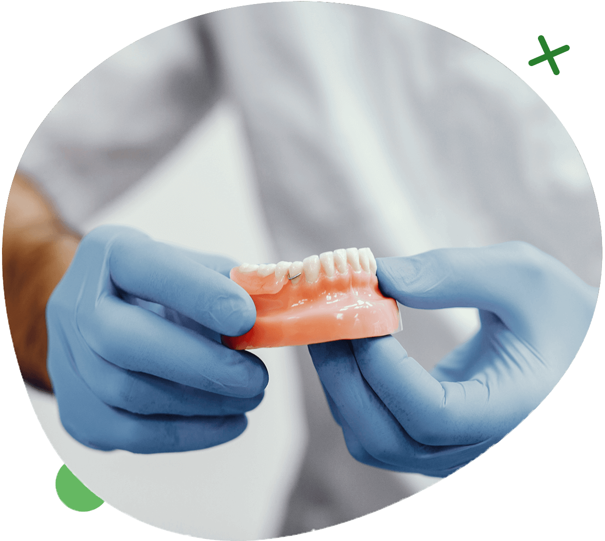 proteticka-min https://www.benedent.sk/wp-content/uploads/2022/08/proteticka-min.png